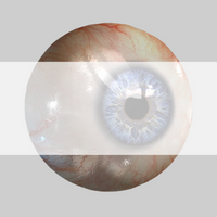 Focusing Ability, Comprehensive eye exam