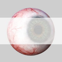 Eye Motility, Comprehensive eye exam