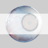 Cataracts, comprehensive eye exam burnaby