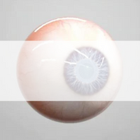 Glaucoma, comprehensive eye exam vancouver