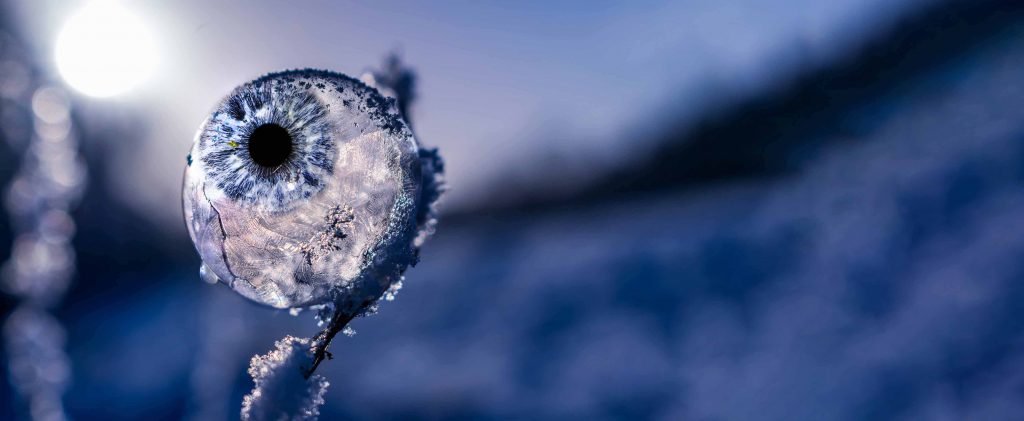 Winter dry eyes