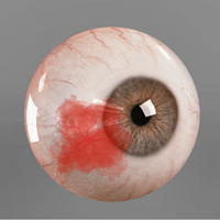 Senior Eye Exams Burnaby | Vision Changes After 65 & MSP Coverage 8 Diabetic Retinopathy