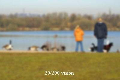 How Bad Is My Eye Prescription? Decoded in 3 Steps 6 How Bad Is My Eye Prescription