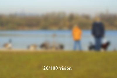 How Bad Is My Eye Prescription? Decoded in 3 Steps 8 How Bad Is My Eye Prescription