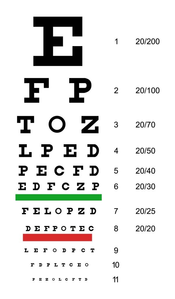 Comprehensive Eye Exam Burnaby Metrotown